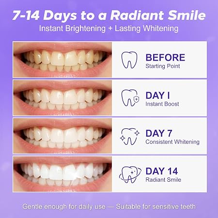 Purple Teeth Whitening Strips 28 Count - 14 Days Treatment Whitener Strips